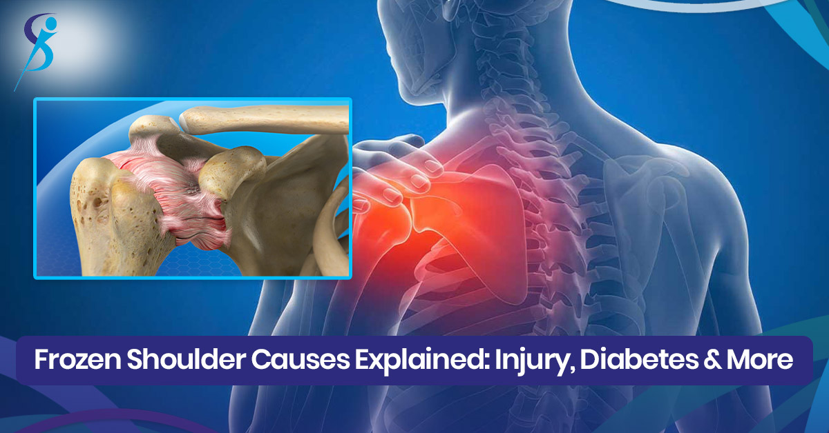 Frozen Shoulder Causes Explained blog image