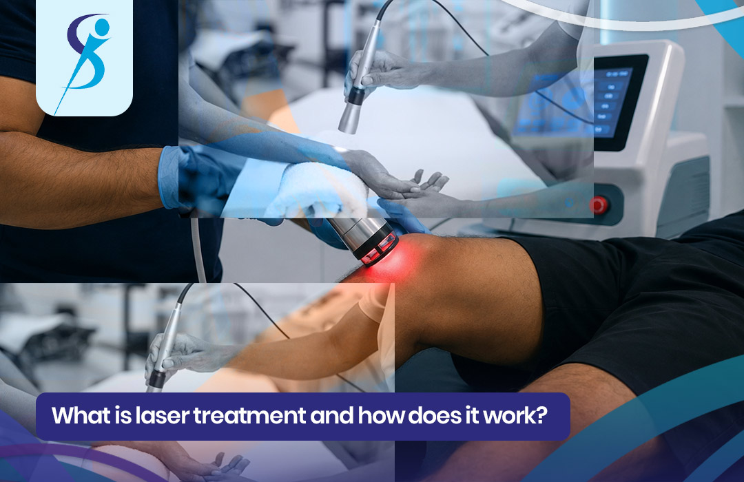 What is laser treatment and how does it work? Complete guide